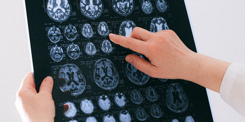 Médico analisando exame de imagem cerebral, ilustrando o sistema endocanabinoide e sua ação no cérebro